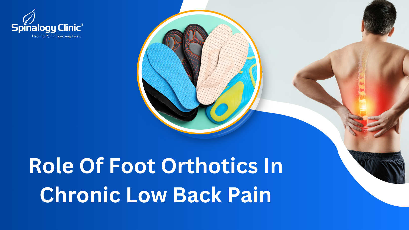 Role Of Foot Orthotics In Chronic Low Back Pain